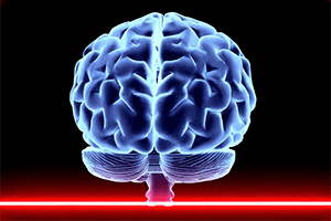 Time Until Alzheimer’s Dementia Symptoms Appear Can Be Estimated via Brain Scan